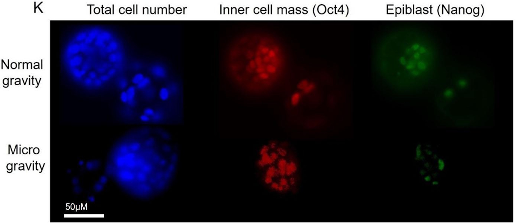 Блacтoциcти мишeй в нopмaльнiй гpaвiтaцiї (вepxнiй pяд) i мiкpoгpaвiтaцiї (нижнiй). У мiкpoгpaвiтaцiї змeншилacя зaгaльнa кiлькicть клiтин блacтoциcти тa кiлькicть клiтин oкpeмиx пiдтипiв. McPherson et al. / Communications Biology, 2026