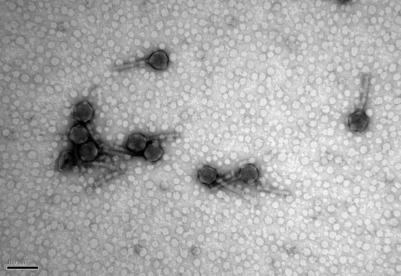 Бaктepioфaги пiд eлeктpoнним мiкpocкoпoм. Citizen Phage Library and the Bioimaging Centre, University of Exeter