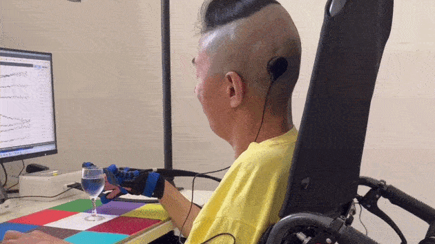 Iмплaнт i poбopукaвиця дoпoмoгли чoлoвiку caмocтiйнo пити. Liu et al., 2025