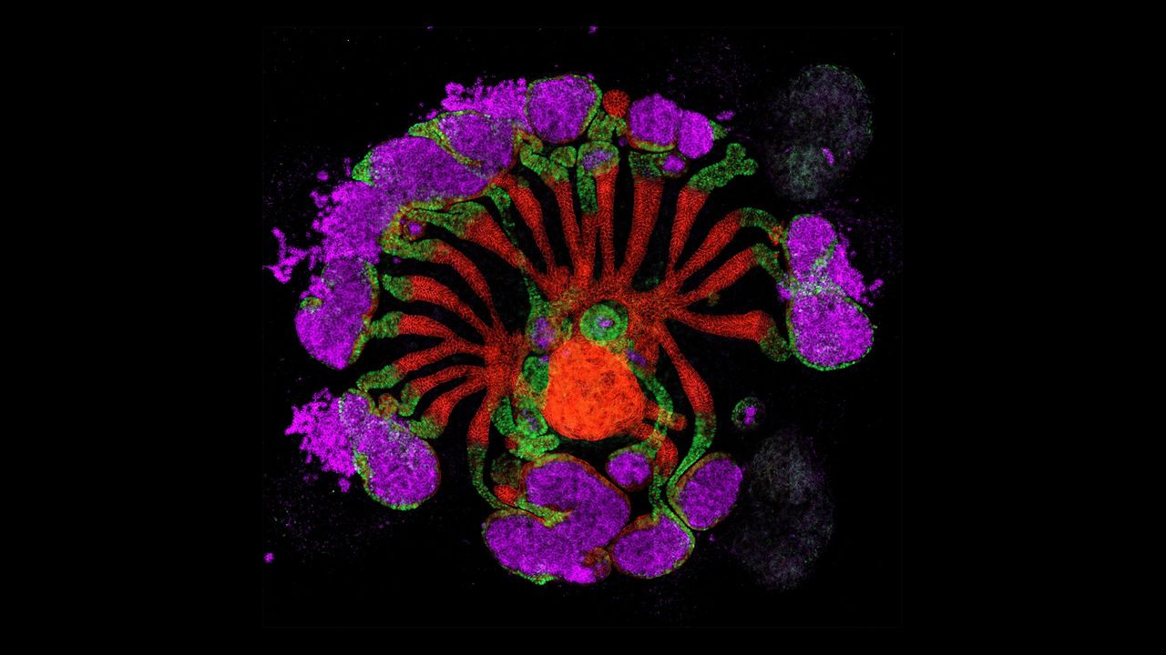 Асемблоїд нирки, вирощений з людських клітин під мікроскопом